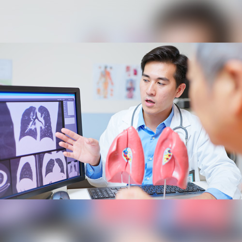IN THE NEWS: Understanding Non-Small Cell Lung Cancer